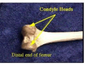 Bone Condyles on human knee