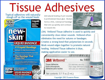 Tissue Adhesives