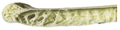 Cross-section of a hollow (pneumatic) bird bone showing trabiculae