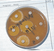 C:\Users\Jeannine\Pictures\Bacteria basic health and disease in Birds, Michael Cannon.PNG